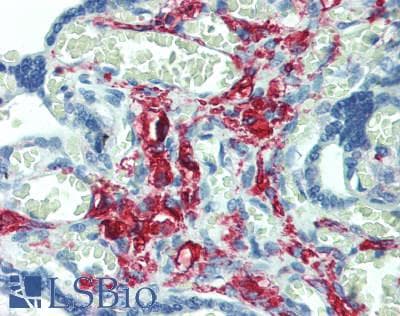 Ferritin Antibody