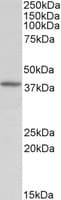 IHC-plus™ DCN / Decorin Antibody (aa232-246)
