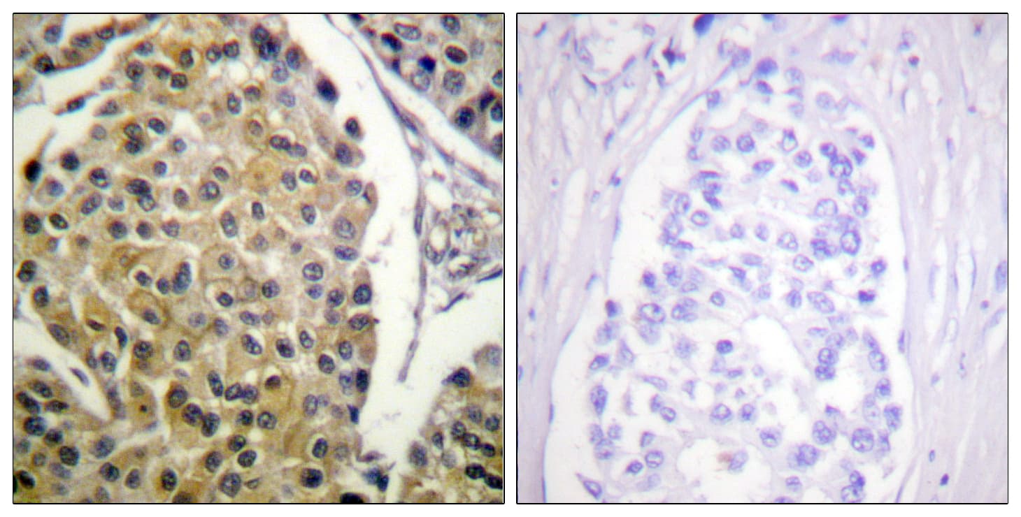 PRKCD / PKC-Delta Antibody (phospho-Tyr313)