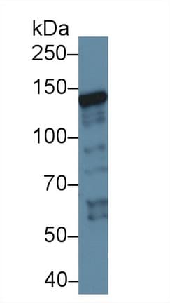 XPC Antibody (aa734-933, FITC)