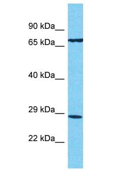 T2R13 / TAS2R13 Antibody (aa151-200)