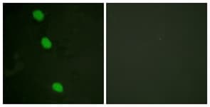 CAMK4 / CaMK IV Antibody (phospho-Thr196/Thr200)
