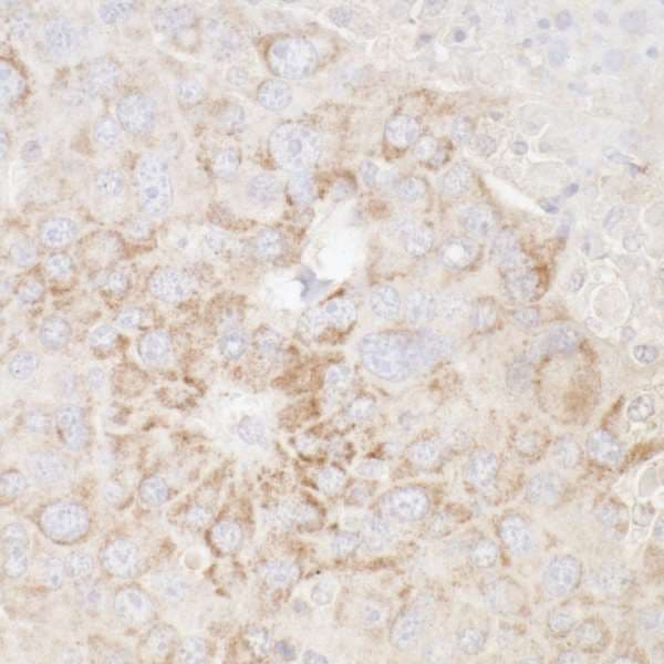 Polyclonal Rabbit anti-Human ATP5A1 / ATP Synthase Alpha Antibody (aa175-225, IHC, WB)
