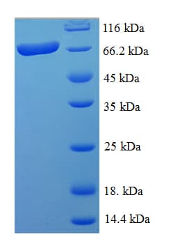 Human ARHGAP19 Protein (Recombinant His-SUMO)