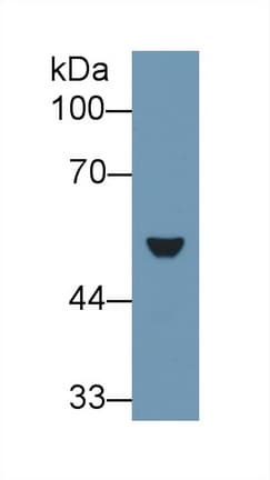 KRT7 / CK7 / Cytokeratin 7 Antibody (aa394-457)