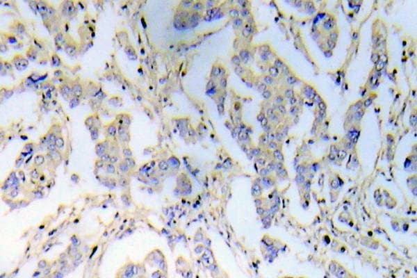 Polyclonal Rabbit anti-Human IRS1 Antibody (Pro618, IHC)