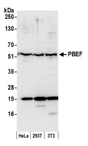 NAMPT / Visfatin Antibody (aa400-450)