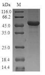 Human SLC25A15 / ORNT1 Protein (Recombinant GST, N-terminus)