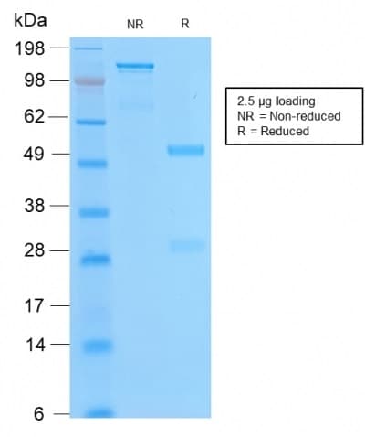 PathPlus™ BCL2 / Bcl-2 Antibody (clone BCL2/2210R)