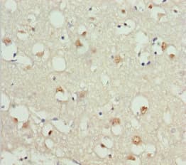GNAO1 Antibody