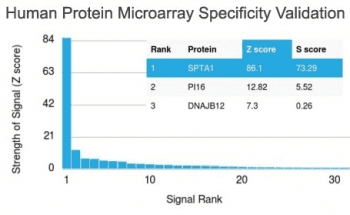 Monoclonal Mouse anti-Human SPTA1 / Alpha Spectrin Antibody (clone SPTA1/1810, Azide-free,BSA-free, IHC)