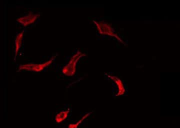 RAB29 / RAB7L1 Antibody