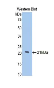 NOS1 / nNOS Antibody (aa468-616)