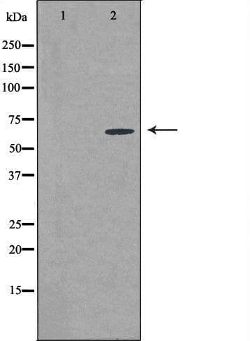 CSTF2T Antibody