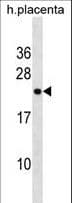 Polyclonal Rabbit anti-Human RNF122 Antibody (aa84-110, WB)