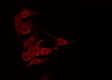 ANGPTL7 / CDT6 Antibody (aa300-320)