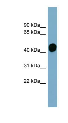 HP / Haptoglobin Antibody (aa287-336)