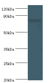 BACH1 Antibody (aa1-320)