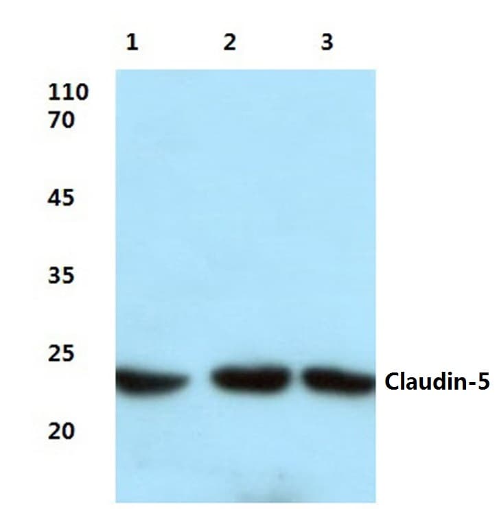 IHC-plus™ Polyclonal Rabbit anti-Human CLDN5 / Claudin 5 Antibody (aa171-220, IHC, IF, WB)