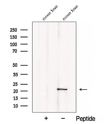 CSRP3 Antibody