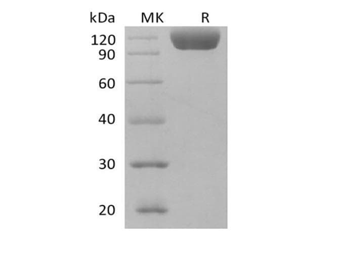 Human SIGLEC10 Protein (Recombinant Fc, C-terminus)