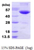 Human UBA3 / UBE1C Protein (Recombinant His)