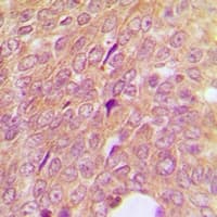 Polyclonal Rabbit anti-Human IGFBP3 Antibody (Internal, IHC, WB)