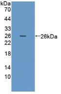 PRSS1 / Trypsin Antibody (aa51-228)