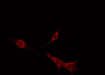 TAS2R16 / T2R16 Antibody