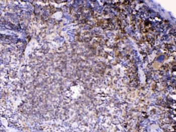 LYN Antibody