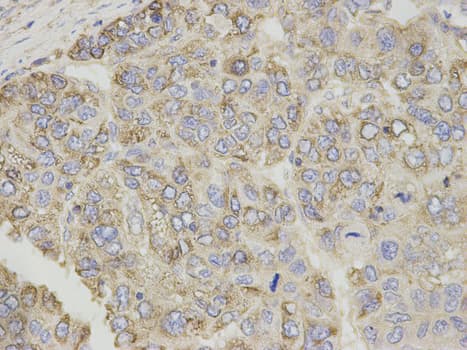 CPT1A Antibody