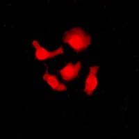IHC-plus™ SRSF3 / SRP20 Antibody (C-Terminus)