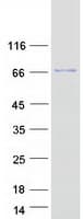 Human ASTE1 Protein (Recombinant Myc-DDK (Flag))