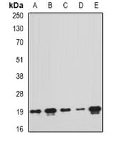 PTRH2 / BIT1 Antibody