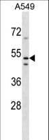 Polyclonal Rabbit anti-Human TMEM200A Antibody (aa15-43, WB)