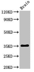 METRNL Antibody
