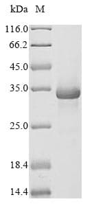 Mouse C1QTNF3 / CTRP3 Protein (Recombinant 10His, N-terminus + Myc, C-terminus)