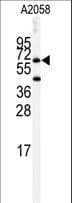BCHE / Cholinesterase Antibody (aa385-415)