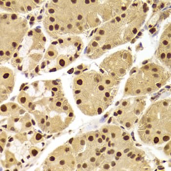 PHAP1 / ANP32A Antibody