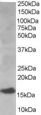 IHC-plus™ Polyclonal Goat anti-Human UBE2I / UBC9 Antibody (aa2-14, IHC, WB)