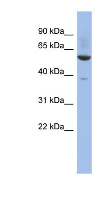 ZNF783 Antibody (aa215-264)
