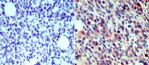 CD207 / Langerin Antibody (aa26-44)