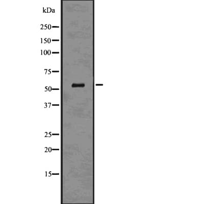 SLC2A2 / GLUT2 Antibody
