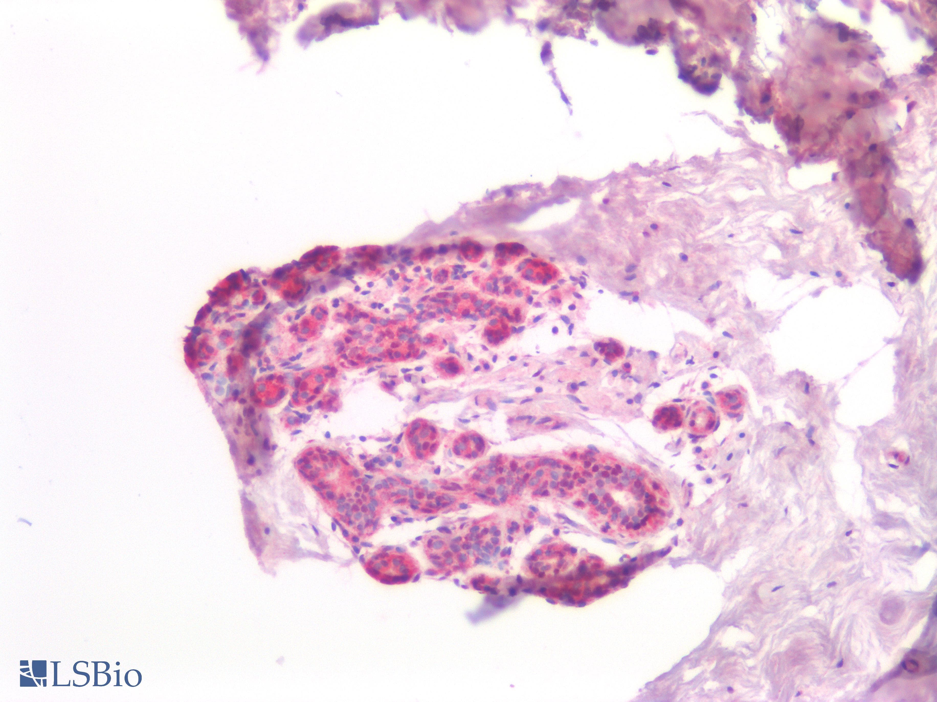 PR / Progesterone Receptor Antibody (Internal)