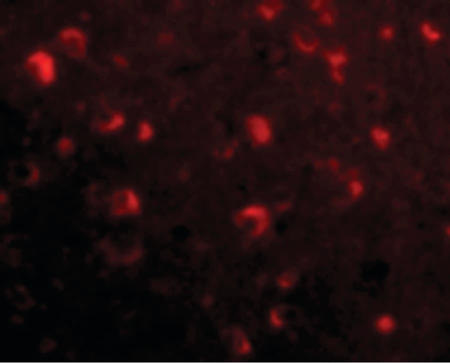 IHC-plus™ SLITRK6 Antibody