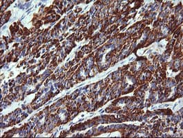 ZSCAN21 / Zipro1 Antibody (clone OTI2E5)