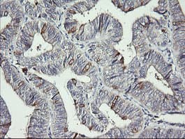 DPCD Antibody (clone OTI4B9)