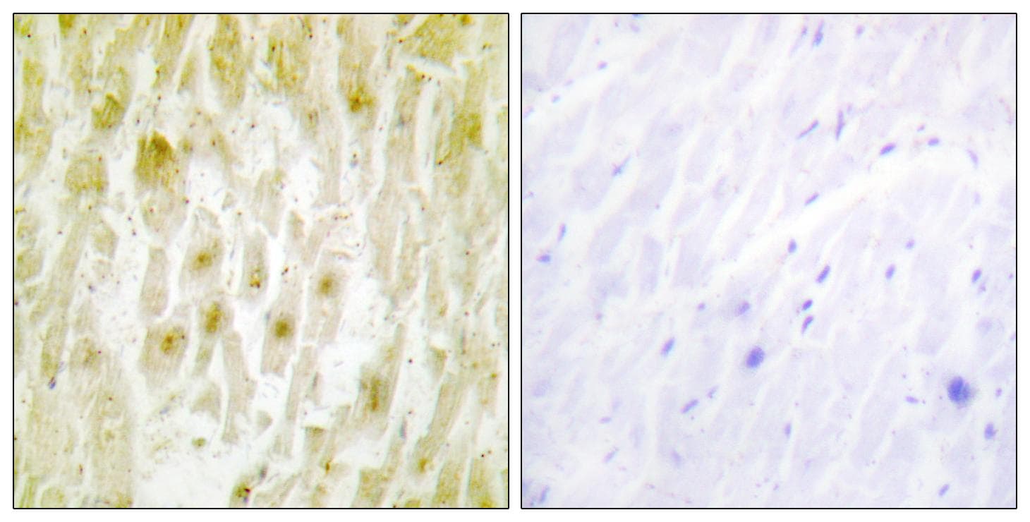 GTF2E2 Antibody
