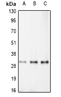 Polyclonal Rabbit anti-Human RDM1 Antibody (Internal, IHC, WB)