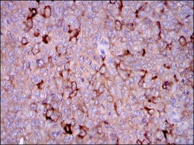 Monoclonal Mouse anti-Human G6PD Antibody (clone 5E+12, IHC, WB)